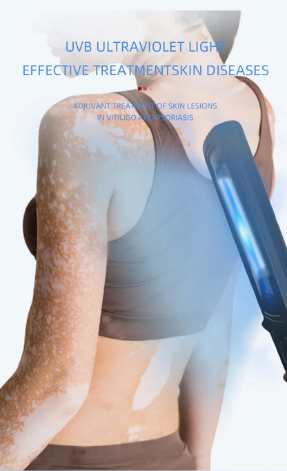 Ultraviolet Phototherapy Instrument Use UVB Lamp