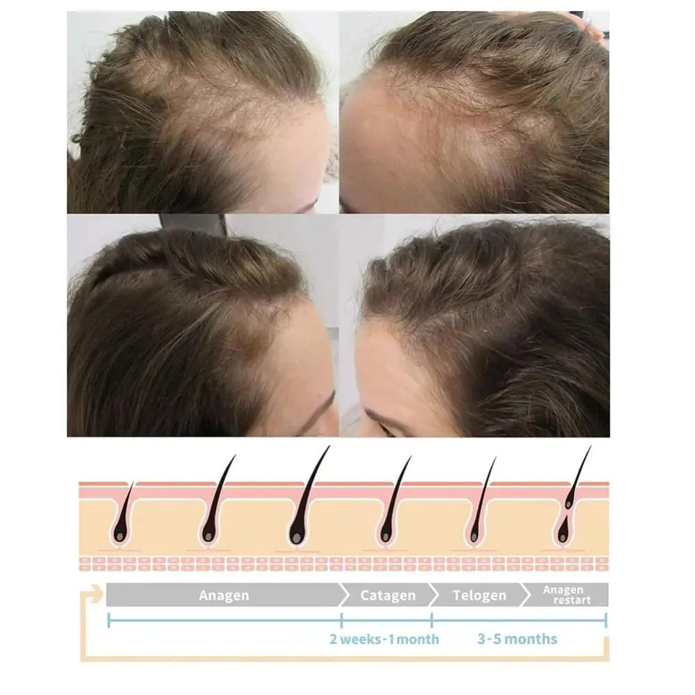 Nourishes Hair Roots Vortex Comb Bundle 4 Settings High Frequency