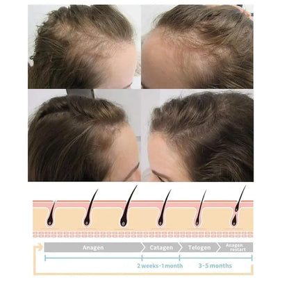 Nourishes Hair Roots Vortex Comb Bundle 4 Settings High Frequency