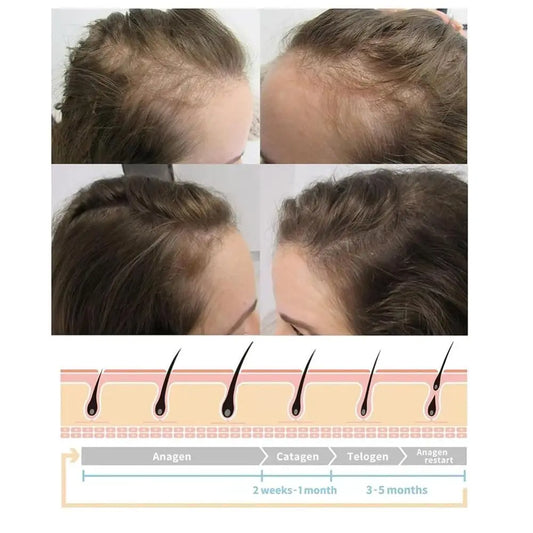 Nourishes Hair Roots Vortex Comb Bundle 4 Settings High Frequency