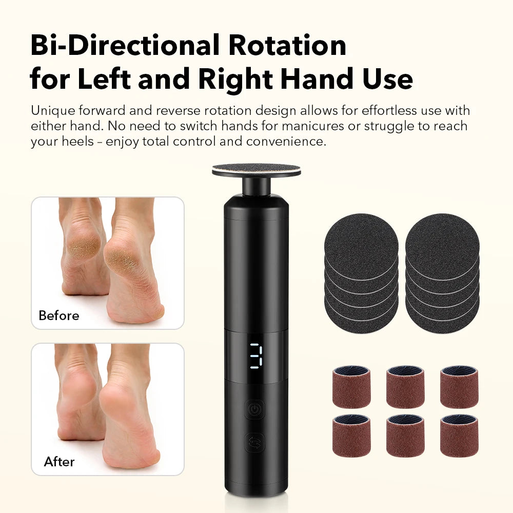 Electric Foot Callus Remover Foot Care File Heels