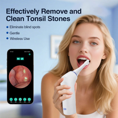 Visible Electric Tonsil Stone Remover Tool Visible Tonsil Stone Removal Kit