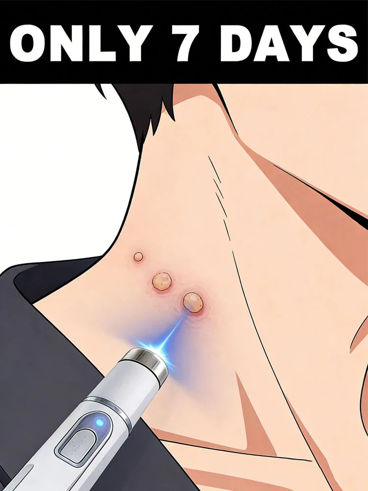 The latest upgraded blue light pen, a best-selling wart removal