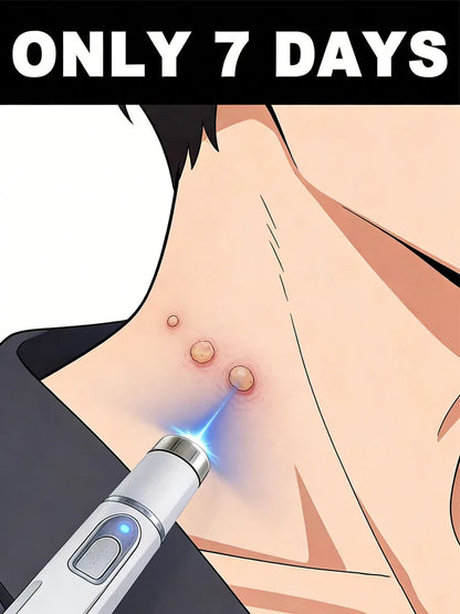 The latest upgraded blue light pen, a best-selling wart removal