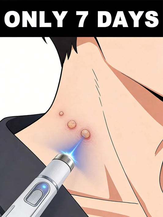 The latest upgraded blue light pen, a best-selling wart removal