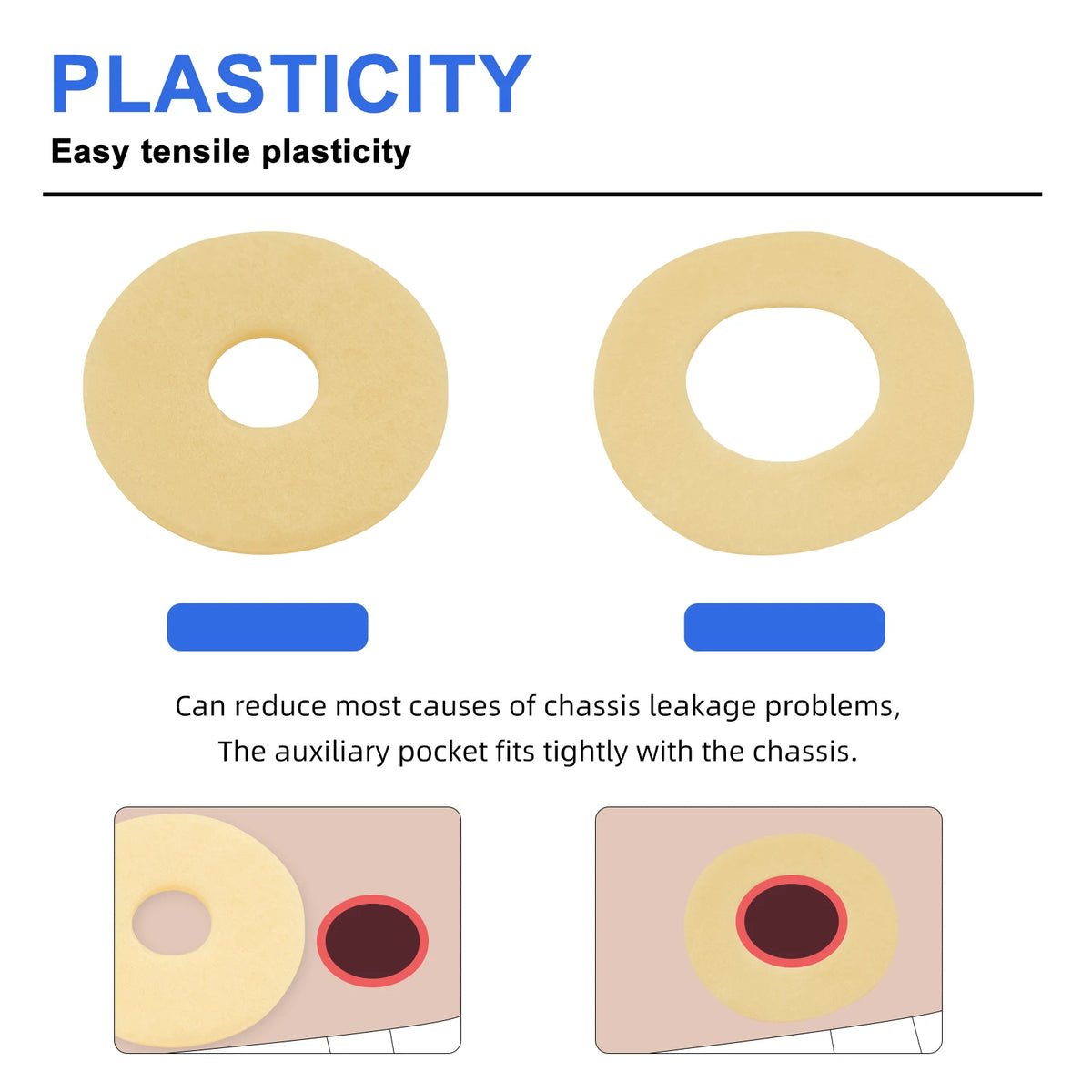 10PCS Ostomy Barrier Rings-Outer Diameter: