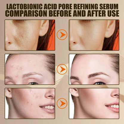 Pore Shrink Face Serum Remove Blackheads Acne Acidity Oil Control
