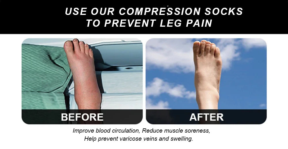 1 Pair Zipper Compression Socks Women Men Pain Relief