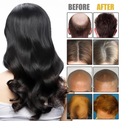 Nourishes Hair Roots Vortex Comb Bundle 4 Settings High Frequency