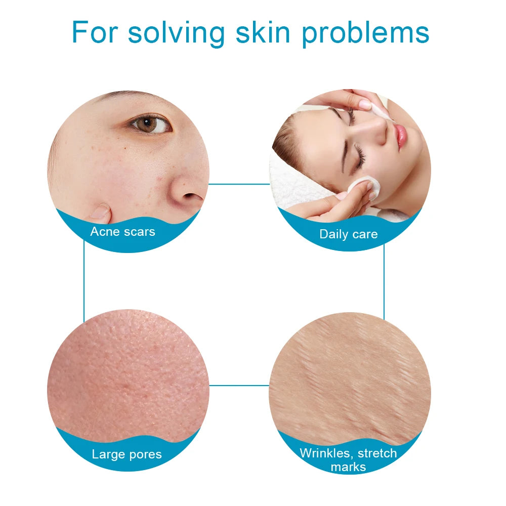 Derma Roller for Facial Body Hair Growth Skin Care Microneedling