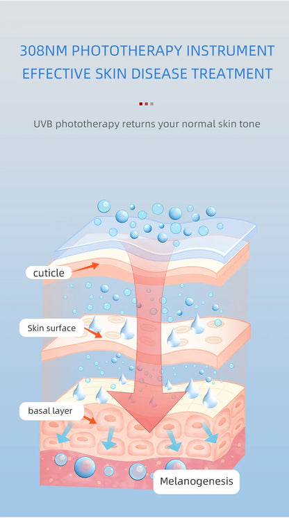 Ultraviolet Phototherapy Instrument Use UVB Lamp
