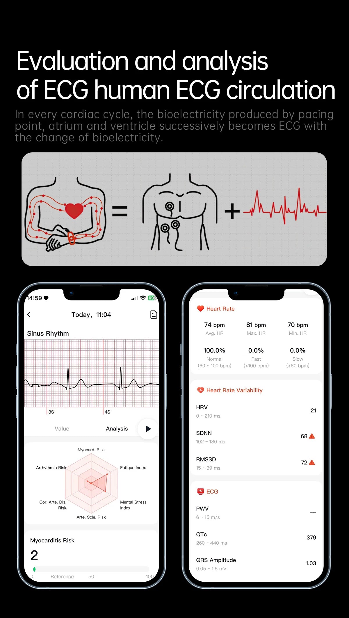 New Nursing Grade ECG+PPG Smart Watch Health Analysis