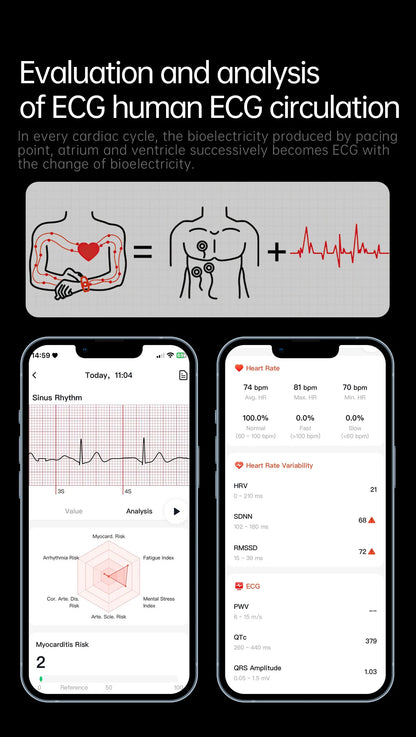 New Nursing Grade ECG+PPG Smart Watch Health Analysis