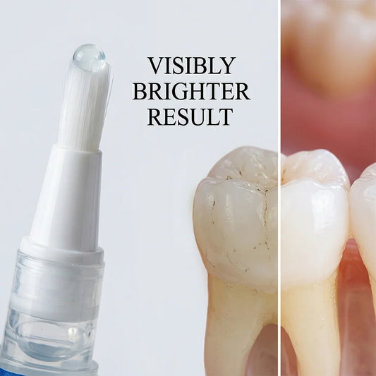 Teeth Whitening Pen Teeth Cleaning Serum Gel Remove