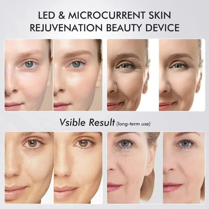 Booster Pro Led Facial Light Therapy Beauty Wand