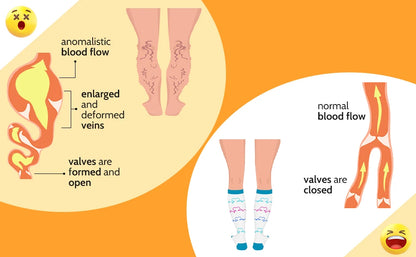 Compression Socks for Women Men Wide Calf