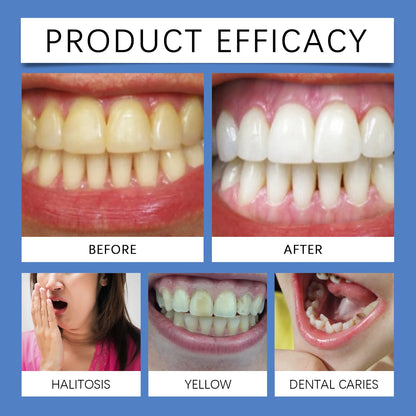 Teeth Whitening Pen Teeth Cleaning Serum Gel Remove