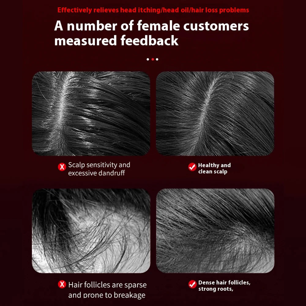 Electric Micro-current Massage Comb Red Light Hair Care