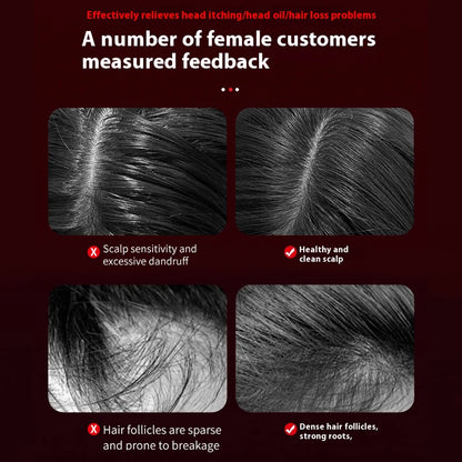 Electric Micro-current Massage Comb Red Light Hair Care