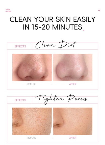 Cherry Blossom Peel Off Mask ,Hydrating & Deep Cleansing