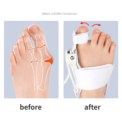 Hallux Valgus Corrector Bunions For Toes Corrector