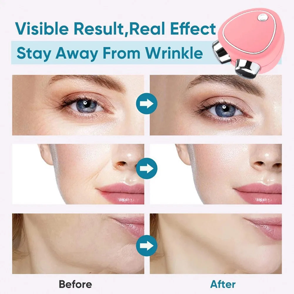 EMS Face Lifting Device Facial Microcurrent Roller Massage