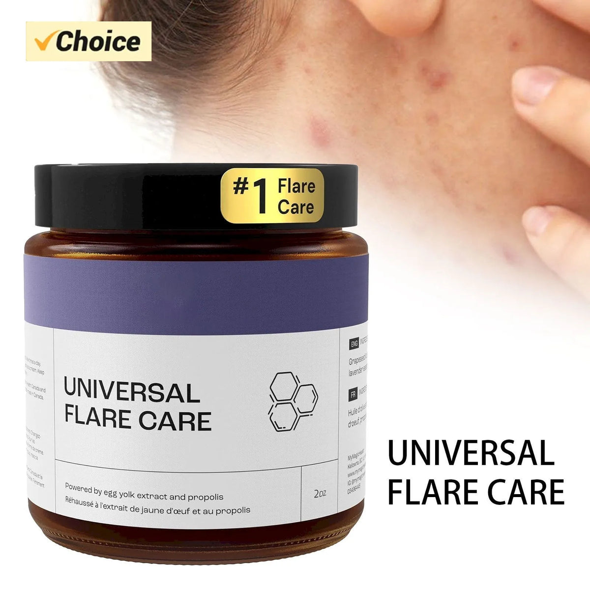 U Niversal | R Elieve Skin Problems | Hidradenitis