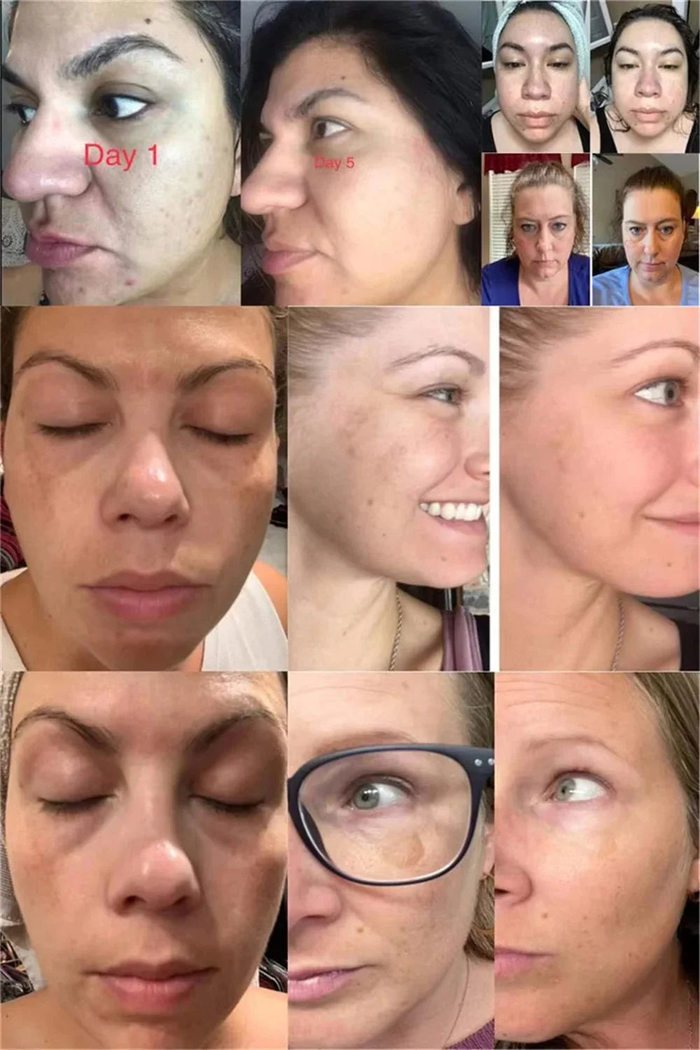 Powerful Spot-Removing Whiten Cream Brighten Skin