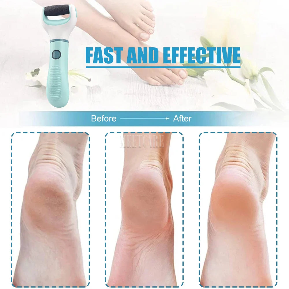 Electric Foot Grinder Remover Dead Skin Professional Grinding
