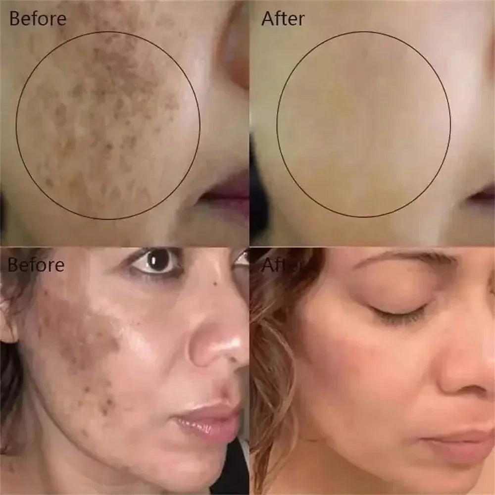 Powerful Spot-Removing Whiten Cream Brighten Skin