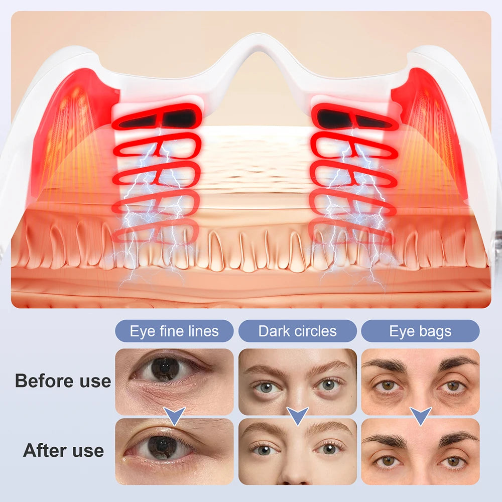 Electric Eye Massager Under-Eye Glasses Relieves Fatigue