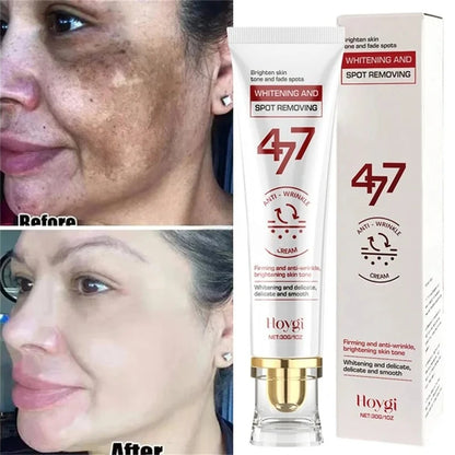 Powerful Spot-Removing Whiten Cream Brighten Skin