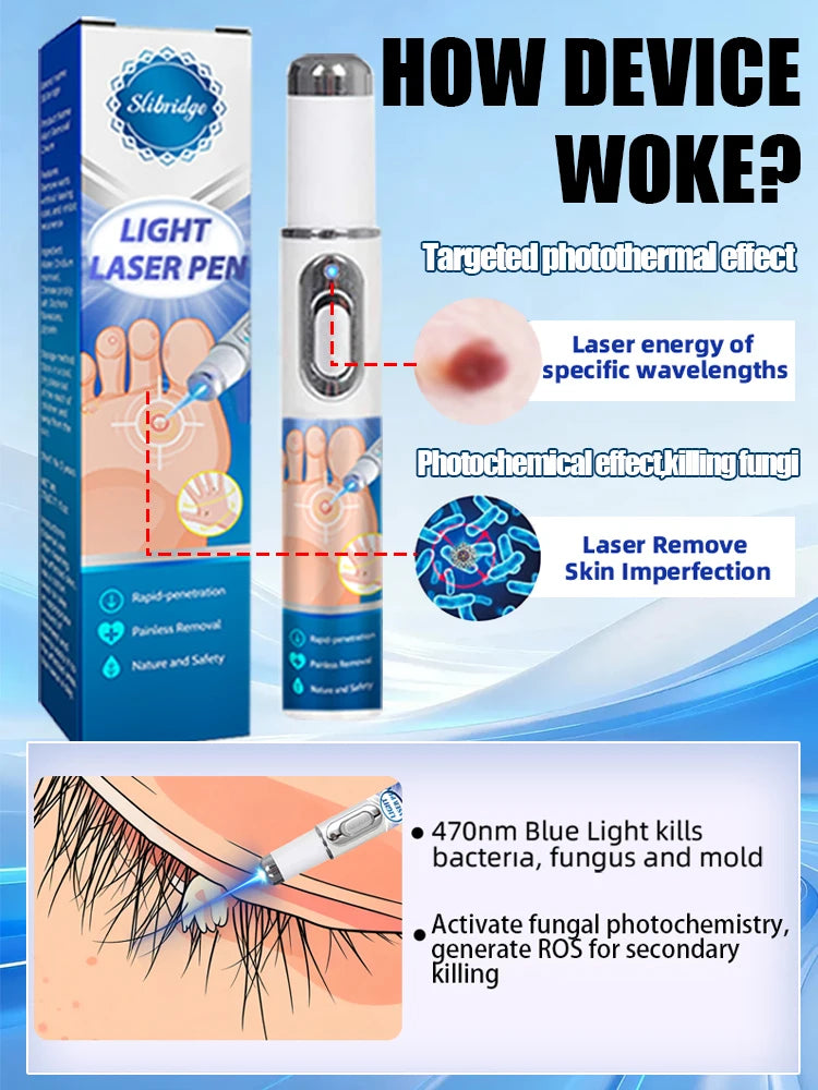 The latest upgraded blue light pen, a best-selling wart removal