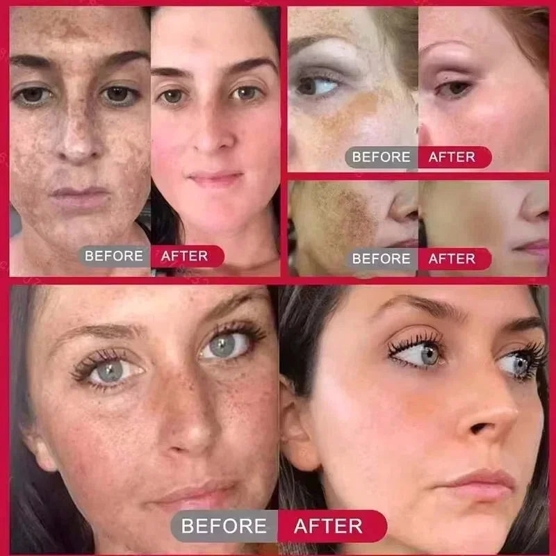 Powerful Spot-Removing Whiten Cream Brighten Skin