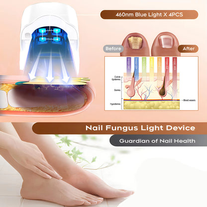 Nail Fungus Laser Treatment LED Light Device