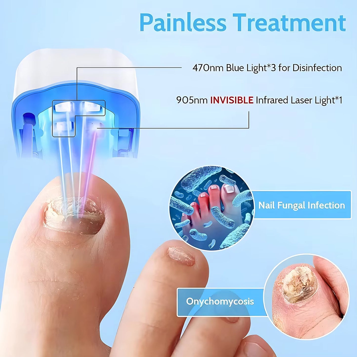 Nail Fungus Laser Treatment LED Light Device