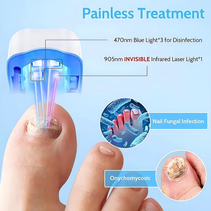 Nail Fungus Laser Treatment LED Light Device