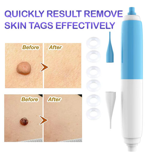 Remove Skin Tags To Remove Meat Ball Tool