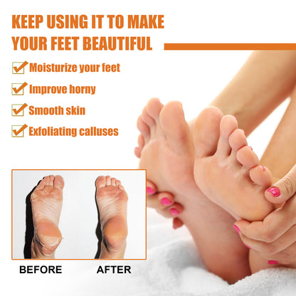 Foot Exfoliating Spray Mild Callose Remove Dead Skin