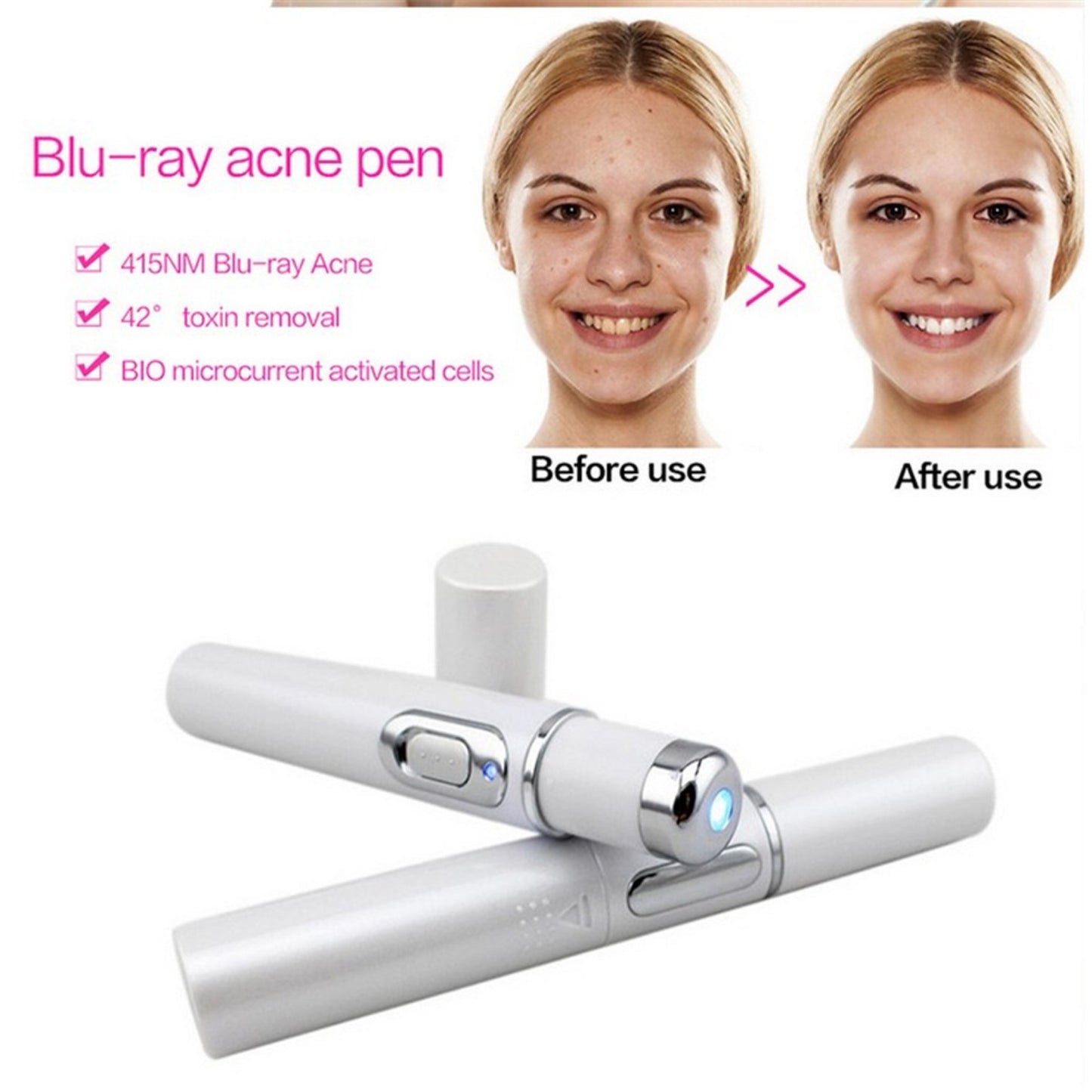 Blue Light Therapy Acne Laser Pen Soft Scar Wrinkle Removal Treatment