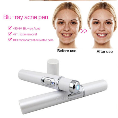 Blue Light Therapy Acne Laser Pen Soft Scar Wrinkle Removal Treatment