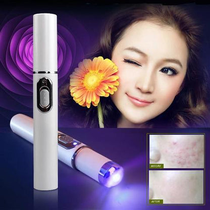 Blue Light Therapy Acne Laser Pen Soft Scar Wrinkle Removal Treatment