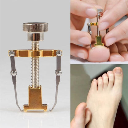 Beauty Ingrown Toenail Corrector Pedicure Toenail Fixer