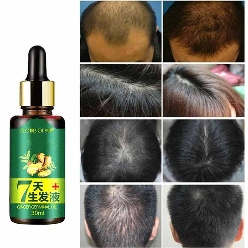 Beauty Germinal Serum Serum Oil Loss Treatment Growth Hair