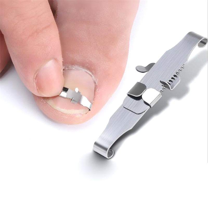 Ingrown toenail corrector Tools Health Product toenail correction Foot Care Tool