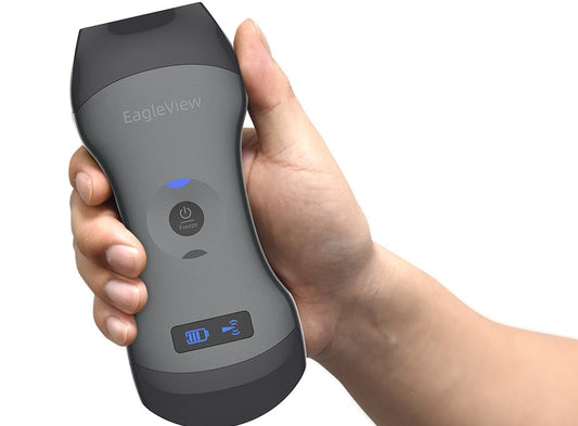 Mini Ge Ultrasound Device Linear Probe Sonoscape Health Product