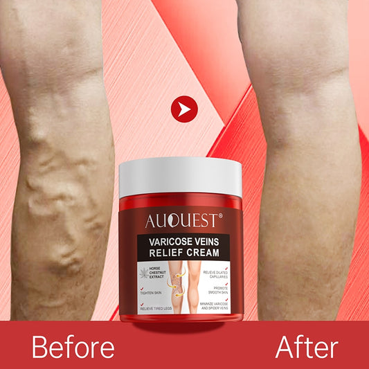Varicose Veins Relief Cream Pain Relief Health Product
