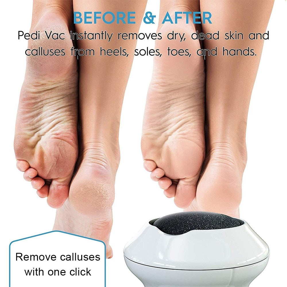 Beauty Electric Foot File Grinder Dead Skin Callus Remover
