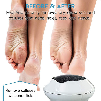 Beauty Electric Foot File Grinder Dead Skin Callus Remover