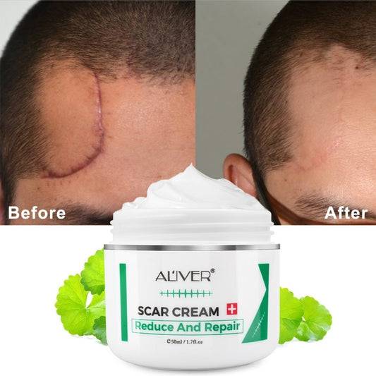 Advanced Treatment For Face & Body Old & New Scars Health Product